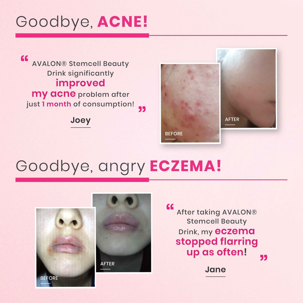 AVALON® Stemcell Beauty Drink